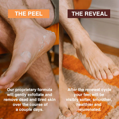 SeoulSkin Glycolic Acid Foot Peeling Mask (1 Pair), Korean Peeling & Exfoliating | Deep Exfoliation with Glycolic Acid, Removes Dead Skin, Cruelty-Free, Foot Peel Off Mask